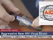 Aggressive New HIV Virus Strain Progresses To AIDS In Less Than 3 Weeks
